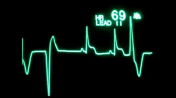 heart monitor flatline gif