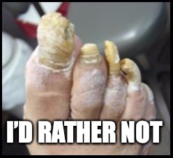 Ugly Toe Nails | I’D RATHER NOT | image tagged in ugly toe nails | made w/ Imgflip meme maker