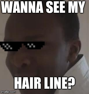 ksi | WANNA SEE MY; HAIR LINE? | image tagged in ksi | made w/ Imgflip meme maker