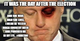 Bill black eye | IT WAS THE DAY AFTER THE ELECTION; AND SHE WAS MAD SHE LOST, I MEAN HE YELLED MAGA COUNTRY MFER AND PUNCHED ME IN MY EYE.  #HIMTOO | image tagged in bill clinton | made w/ Imgflip meme maker