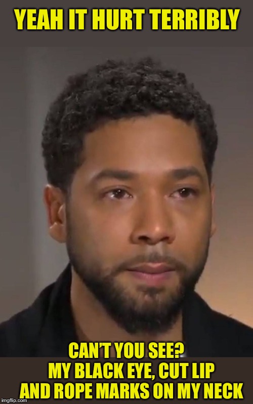 Jussie, pretending he got beat up like a little...? | YEAH IT HURT TERRIBLY; CAN’T YOU SEE?   MY BLACK EYE, CUT LIP AND ROPE MARKS ON MY NECK | image tagged in memes,jussie smollett,attack,or is it,fake news | made w/ Imgflip meme maker
