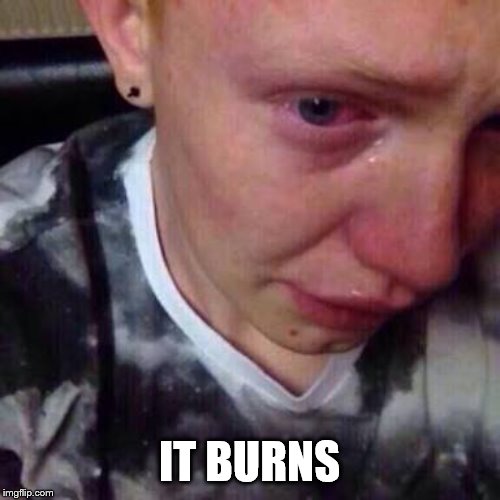 Feel like pure shit | IT BURNS | image tagged in feel like pure shit | made w/ Imgflip meme maker