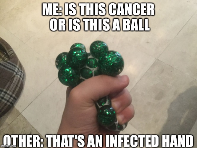 ME: IS THIS CANCER OR IS THIS A BALL; OTHER: THAT'S AN INFECTED HAND | image tagged in infected hand | made w/ Imgflip meme maker