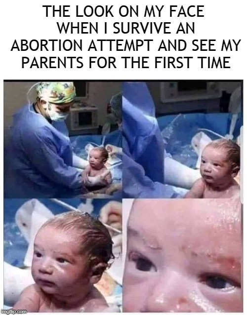 THE LOOK ON MY FACE WHEN I SURVIVE AN ABORTION ATTEMPT AND SEE MY PARENTS FOR THE FIRST TIME | image tagged in abortion survivor stink eye,abortion,abortion is murder,survivor,baby,angry baby | made w/ Imgflip meme maker