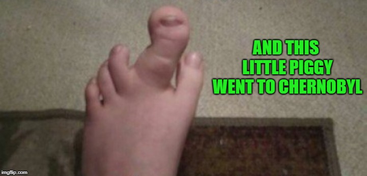 toegetherness | AND THIS LITTLE PIGGY WENT TO CHERNOBYL | image tagged in weird toe,gross | made w/ Imgflip meme maker
