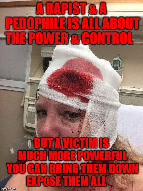 Trump Victim | A RAPIST & A PEDOPHILE IS ALL ABOUT THE POWER & CONTROL; BUT A VICTIM IS MUCH MORE POWERFUL YOU CAN BRING THEM DOWN EXPOSE THEM ALL | image tagged in trump victim | made w/ Imgflip meme maker