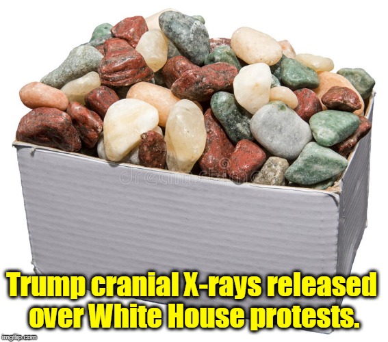 Trump cranial X-rays released over White House protests. | image tagged in trump,brain,white house | made w/ Imgflip meme maker