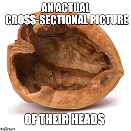 Nutshell | AN ACTUAL CROSS-SECTIONAL PICTURE OF THEIR HEADS | image tagged in nutshell | made w/ Imgflip meme maker