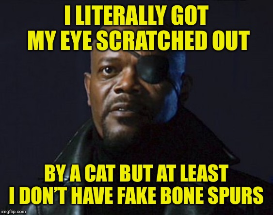 Nick Fury | I LITERALLY GOT MY EYE SCRATCHED OUT; BY A CAT BUT AT LEAST I DON’T HAVE FAKE BONE SPURS | image tagged in nick fury | made w/ Imgflip meme maker