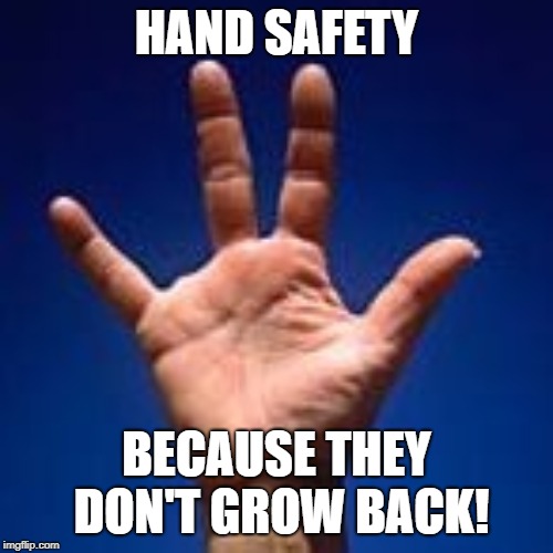 Missing finger | HAND SAFETY; BECAUSE THEY DON'T GROW BACK! | image tagged in missing finger | made w/ Imgflip meme maker