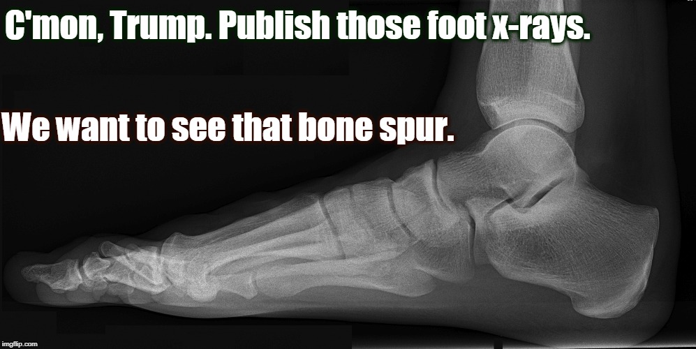 C'mon, Trump. Publish those foot x-rays. We want to see that bone spur. | image tagged in trump,draft dodger,vietnam,bone spur,x-ray | made w/ Imgflip meme maker