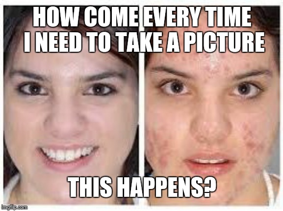 Its so gross. | HOW COME EVERY TIME I NEED TO TAKE A PICTURE; THIS HAPPENS? | image tagged in before and after acne meme,puberty,picture | made w/ Imgflip meme maker