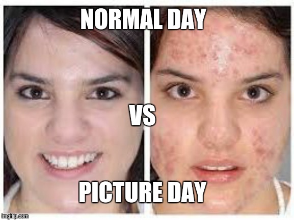 Every effing time | NORMAL DAY; VS; PICTURE DAY | image tagged in before and after acne meme,picture day,puberty | made w/ Imgflip meme maker