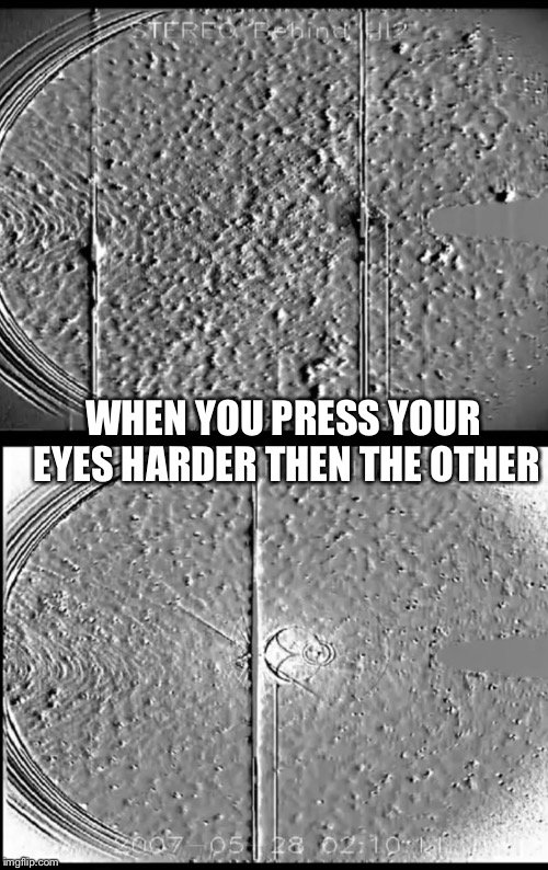 Agh I think I'm blind | WHEN YOU PRESS YOUR EYES HARDER THEN THE OTHER | image tagged in imaging,eyes | made w/ Imgflip meme maker