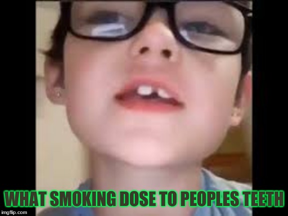 nba white FAGGG | WHAT SMOKING DOSE TO PEOPLES TEETH | image tagged in funny,nbawhiteboy | made w/ Imgflip meme maker