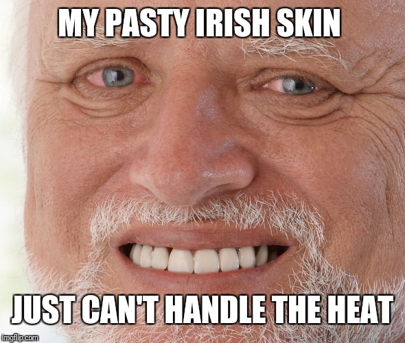 Hide the Pain Harold | MY PASTY IRISH SKIN JUST CAN'T HANDLE THE HEAT | image tagged in hide the pain harold | made w/ Imgflip meme maker