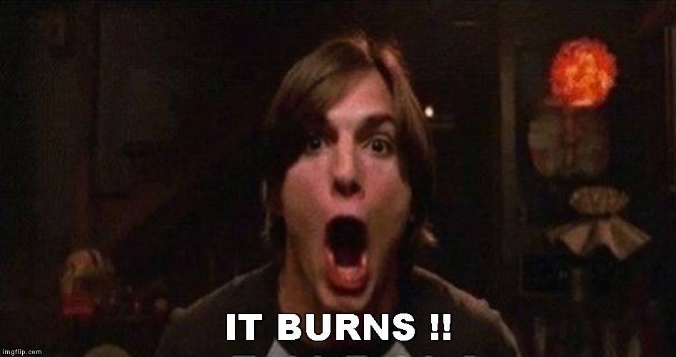 Kelso Burn | IT BURNS !! | image tagged in kelso burn | made w/ Imgflip meme maker