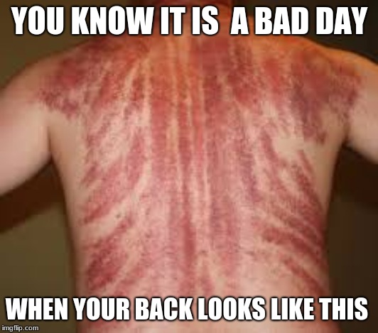 YOU KNOW IT IS  A BAD DAY WHEN YOUR BACK LOOKS LIKE THIS | made w/ Imgflip meme maker