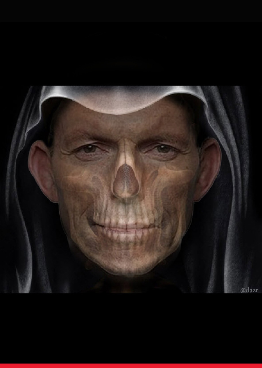 Tony Abbott Blank Meme Template