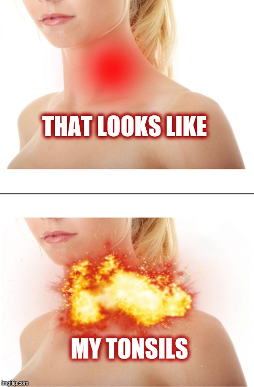 Throat Explosion | THAT LOOKS LIKE MY TONSILS | image tagged in throat explosion | made w/ Imgflip meme maker