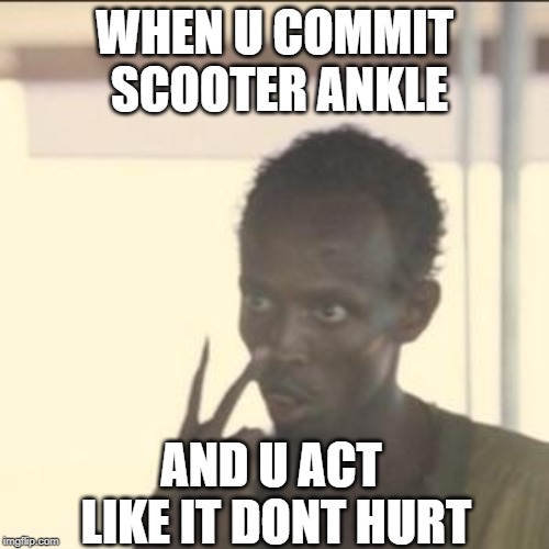 Look At Me | WHEN U COMMIT SCOOTER ANKLE; AND U ACT LIKE IT DONT HURT | image tagged in memes,look at me | made w/ Imgflip meme maker