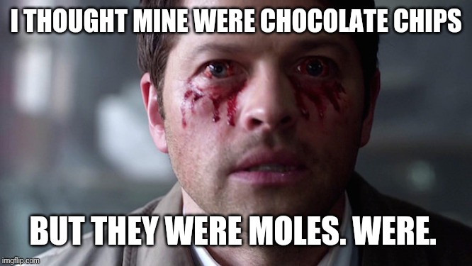 Supernatural eye bleed | I THOUGHT MINE WERE CHOCOLATE CHIPS BUT THEY WERE MOLES. WERE. | image tagged in supernatural eye bleed | made w/ Imgflip meme maker