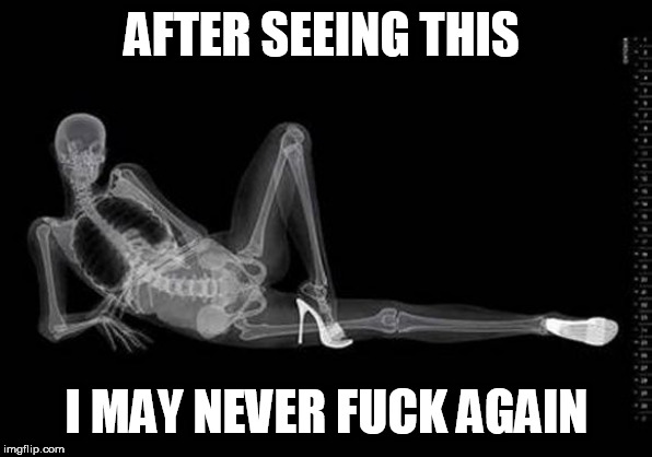 XRAY PORN | AFTER SEEING THIS; I MAY NEVER FUCK AGAIN | image tagged in xray porn | made w/ Imgflip meme maker