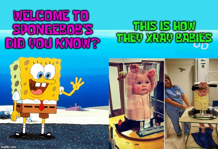 Spongebob Week" April 29th to May 5th an EGOS production. | THIS IS HOW THEY XRAY BABIES; WELCOME TO SPONGEBOB'S DID YOU KNOW? | image tagged in spongebob week,kewlew,no kidding,did you know | made w/ Imgflip meme maker