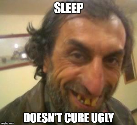 Ugly Guy | SLEEP DOESN'T CURE UGLY | image tagged in ugly guy | made w/ Imgflip meme maker
