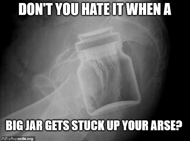 DON'T YOU HATE IT WHEN A; BIG JAR GETS STUCK UP YOUR ARSE? | image tagged in bum | made w/ Imgflip meme maker