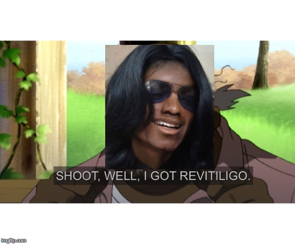 Shoot, well i got Revitiligo. | image tagged in michael jackson,memes,lol,bruh,boondocks | made w/ Imgflip meme maker