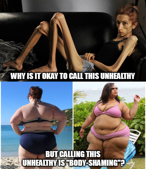 And I'm allowed to say they're fat, because I'm fatand I recognize it as unhealthy. | WHY IS IT OKAY TO CALL THIS UNHEALTHY; BUT CALLING THIS UNHEALTHY IS "BODY-SHAMING"? | image tagged in memes,fat is unhealthy,political correctness is bad | made w/ Imgflip meme maker