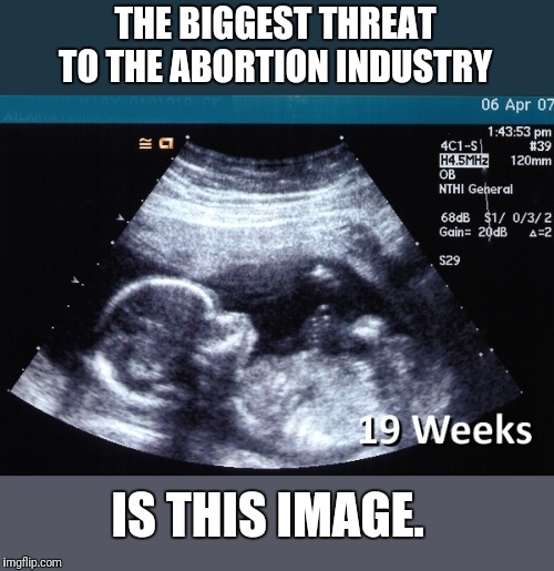 Megatron owners refused to display an ultrasound image in Times Square. Why? | THE BIGGEST THREAT TO THE ABORTION INDUSTRY; IS THIS IMAGE. | image tagged in ultrasound,abortion,pro choice,death | made w/ Imgflip meme maker