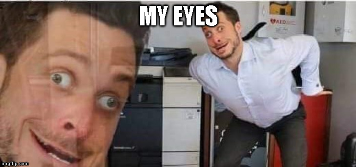 Stupid Googly eyes guy | MY EYES | image tagged in stupid googly eyes guy | made w/ Imgflip meme maker