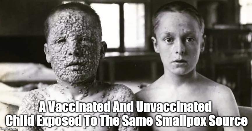 "A Vaccinated And Unvaccinated Child" | A Vaccinated And Unvaccinated Child Exposed To The Same Smallpox Source | image tagged in vaccination,anti-vaxxers,smallpox | made w/ Imgflip meme maker
