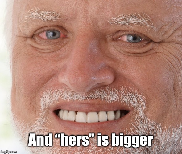 Hide the Pain Harold | And “hers” is bigger | image tagged in hide the pain harold | made w/ Imgflip meme maker