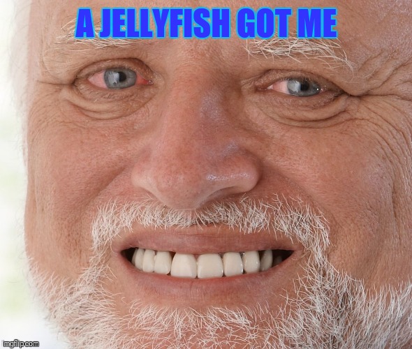 Hide the Pain Harold | A JELLYFISH GOT ME | image tagged in hide the pain harold | made w/ Imgflip meme maker