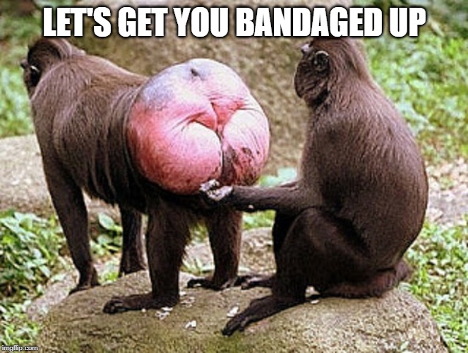 Monkey butt | LET'S GET YOU BANDAGED UP | image tagged in monkey butt | made w/ Imgflip meme maker