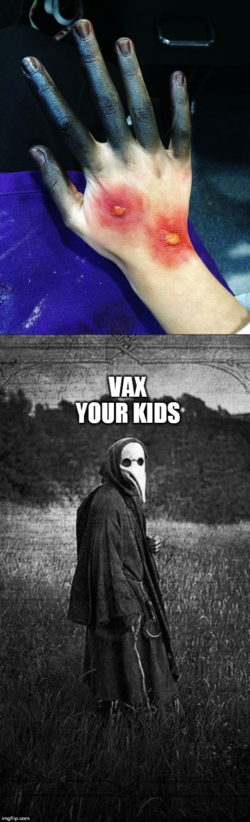 VAX YOUR KIDS | image tagged in anti vax | made w/ Imgflip meme maker
