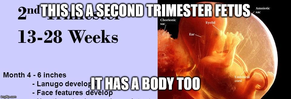 THIS IS A SECOND TRIMESTER FETUS IT HAS A BODY TOO | made w/ Imgflip meme maker