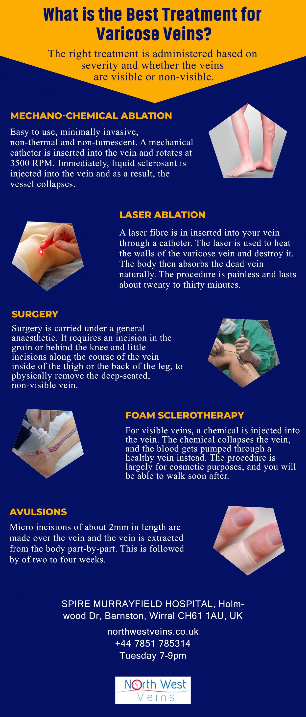 What is the Best Treatment for Varicose Veins Blank Meme Template