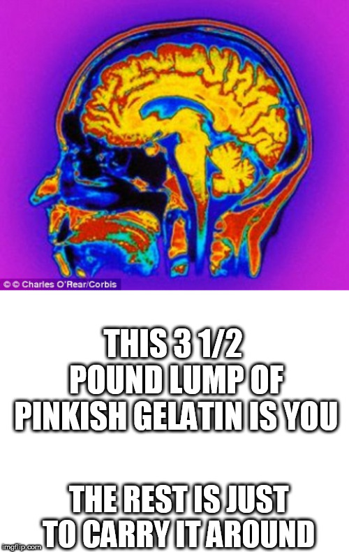 THIS 3 1/2 POUND LUMP OF PINKISH GELATIN IS YOU; THE REST IS JUST TO CARRY IT AROUND | image tagged in blank white template,this is you | made w/ Imgflip meme maker