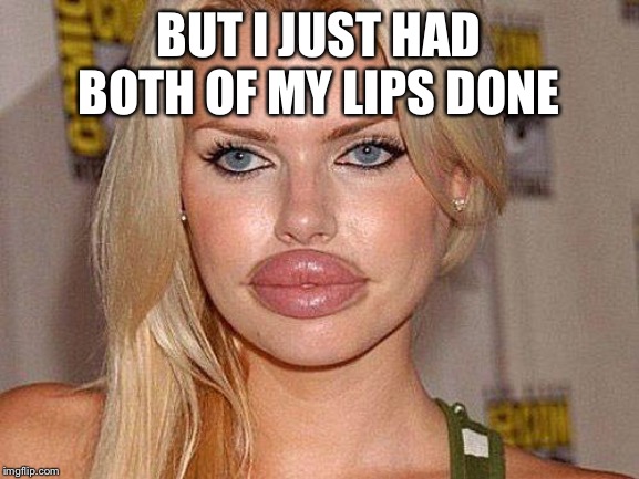 Big Lips | BUT I JUST HAD BOTH OF MY LIPS DONE | image tagged in big lips | made w/ Imgflip meme maker