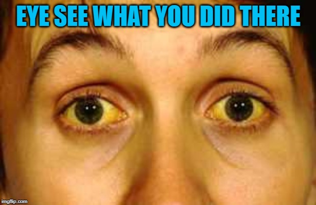 Jaundice | EYE SEE WHAT YOU DID THERE | image tagged in jaundice | made w/ Imgflip meme maker