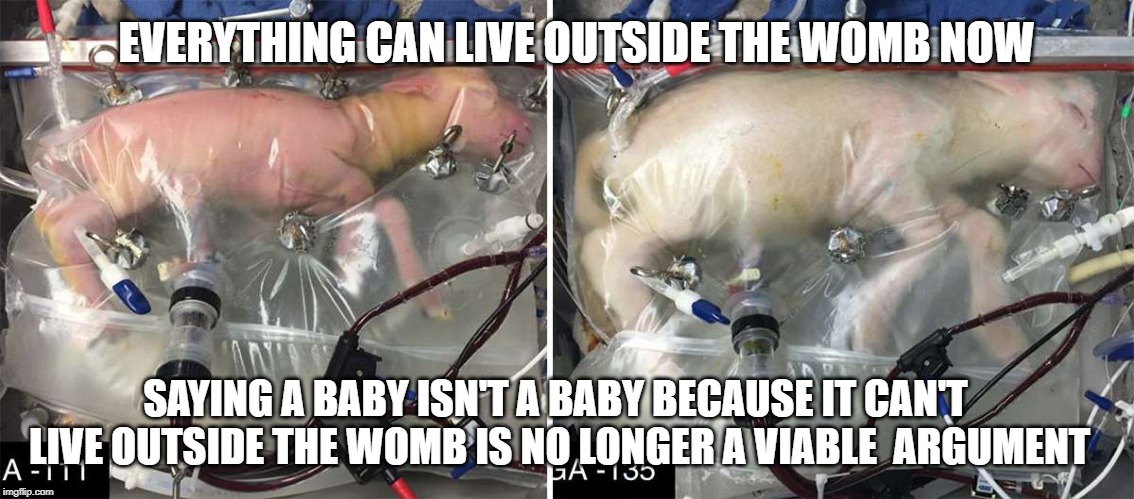 Pro-choice - Make good choices before you're pregnant. | EVERYTHING CAN LIVE OUTSIDE THE WOMB NOW; SAYING A BABY ISN'T A BABY BECAUSE IT CAN'T LIVE OUTSIDE THE WOMB IS NO LONGER A VIABLE  ARGUMENT | image tagged in abortion is murder | made w/ Imgflip meme maker