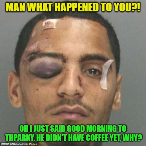 Black Eye | MAN WHAT HAPPENED TO YOU?! OH I JUST SAID GOOD MORNING TO THPARKY, HE DIDN'T HAVE COFFEE YET, WHY? | image tagged in black eye | made w/ Imgflip meme maker
