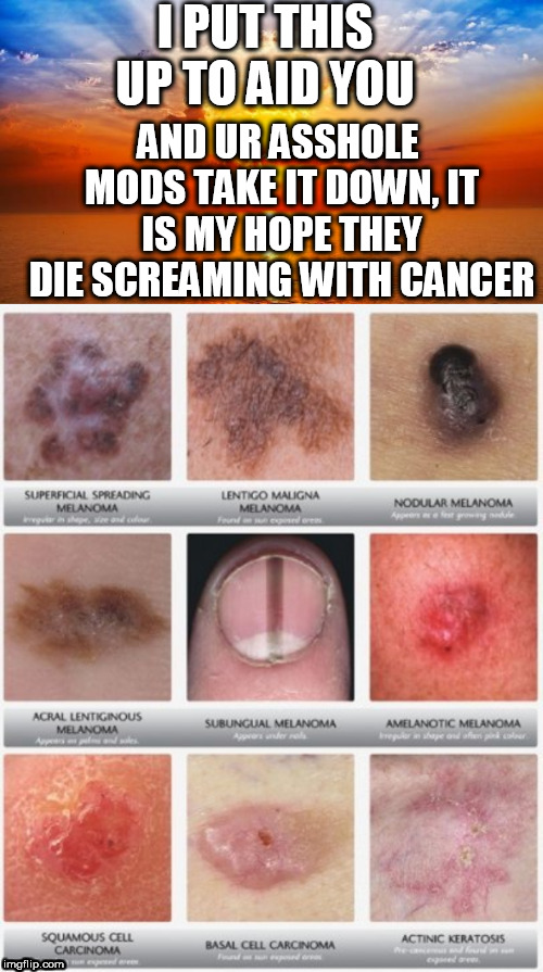 High Quality cancer Blank Meme Template