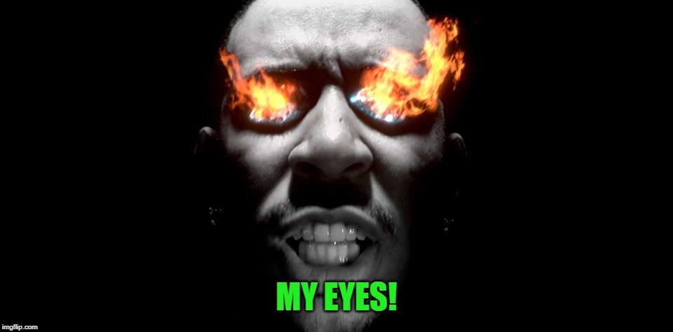 eyes burning | MY EYES! | image tagged in eyes burning | made w/ Imgflip meme maker