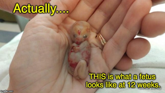 Actually.... THIS is what a fetus looks like at 12 weeks. | made w/ Imgflip meme maker