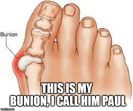 bunny | THIS IS MY BUNION, I CALL HIM PAUL | image tagged in bunny | made w/ Imgflip meme maker
